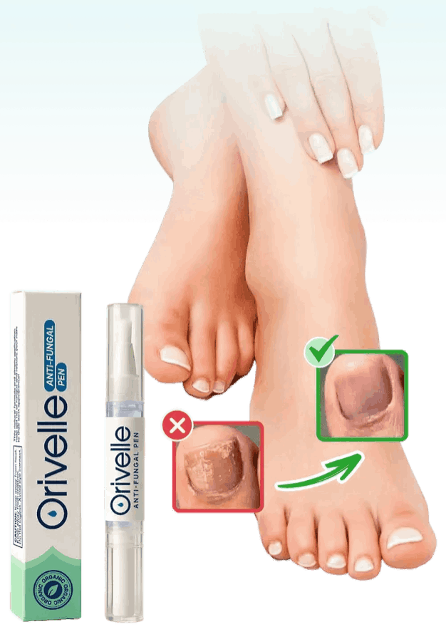 Orivelle Nail Fungus Pen – Official Site – Orivell